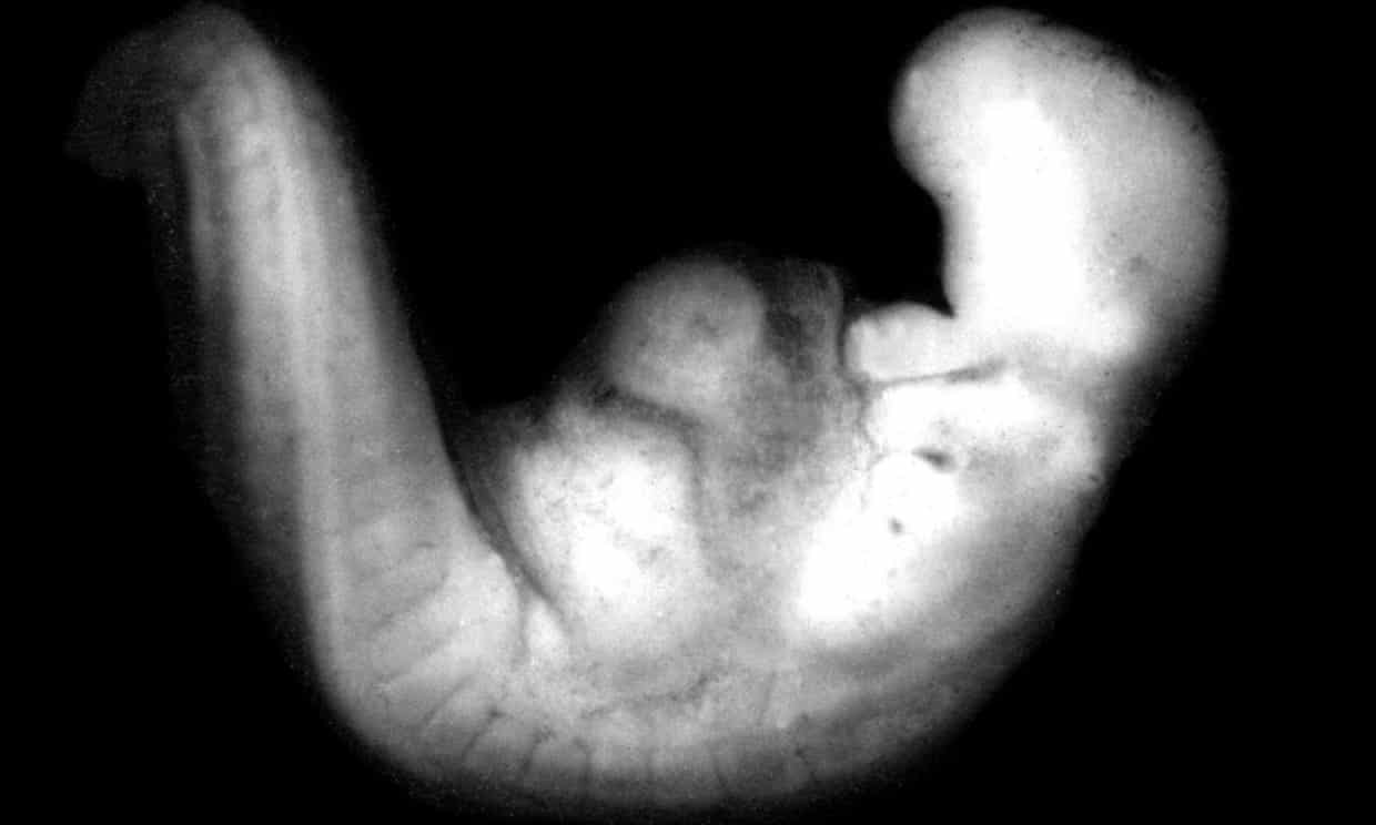 An embryo at 26-30 days