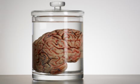 David Charles stole brain specimens and other human tissue, some of which he put on eBay.