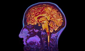 The scientists suggest the drug should be given rapidly to patients with mild to moderate traumatic brain injuries.