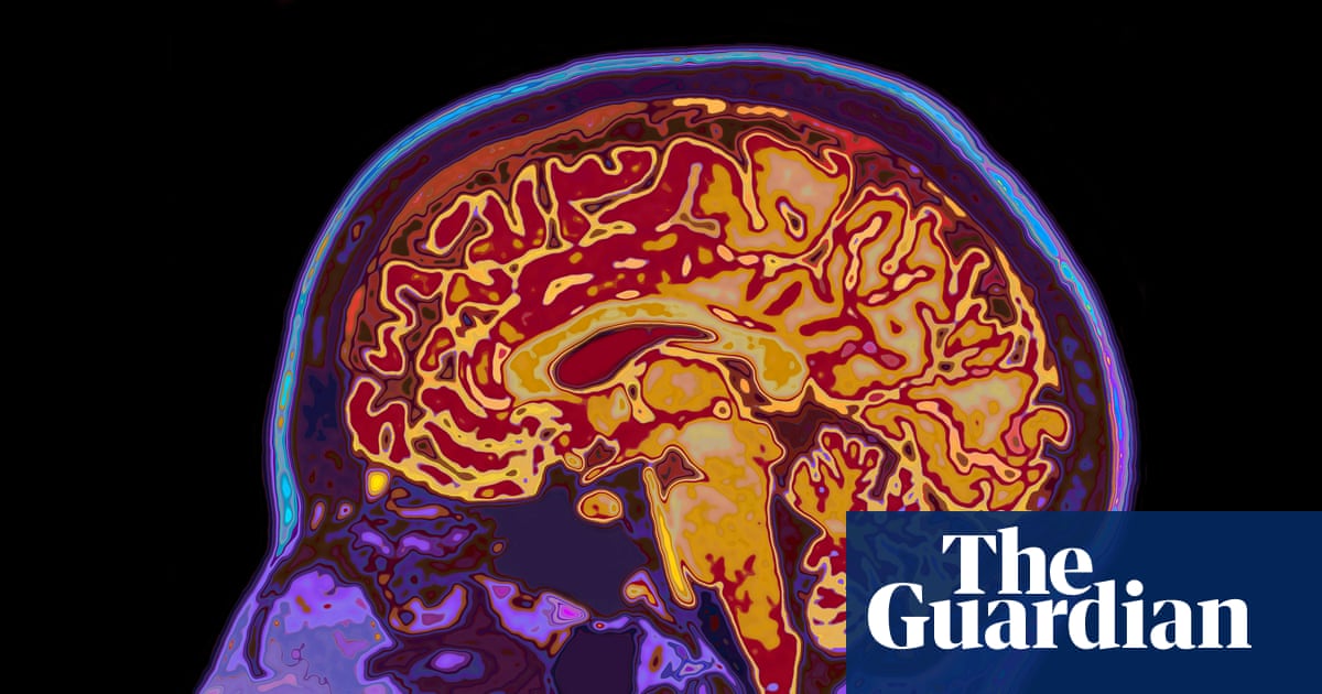 Scans shed light on changes in brain when we zone out while tired | Neuroscience Scans shed light on changes in brain when we zone out while tired | Neuroscience