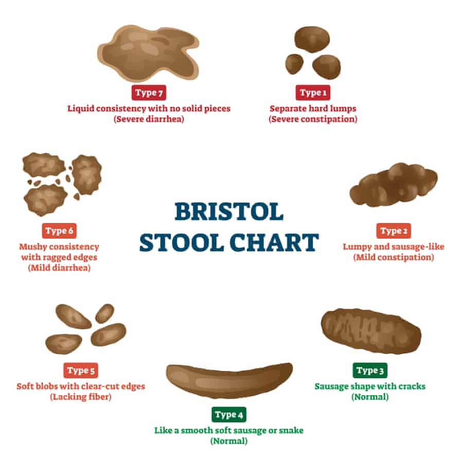 The Bristol stool chart.