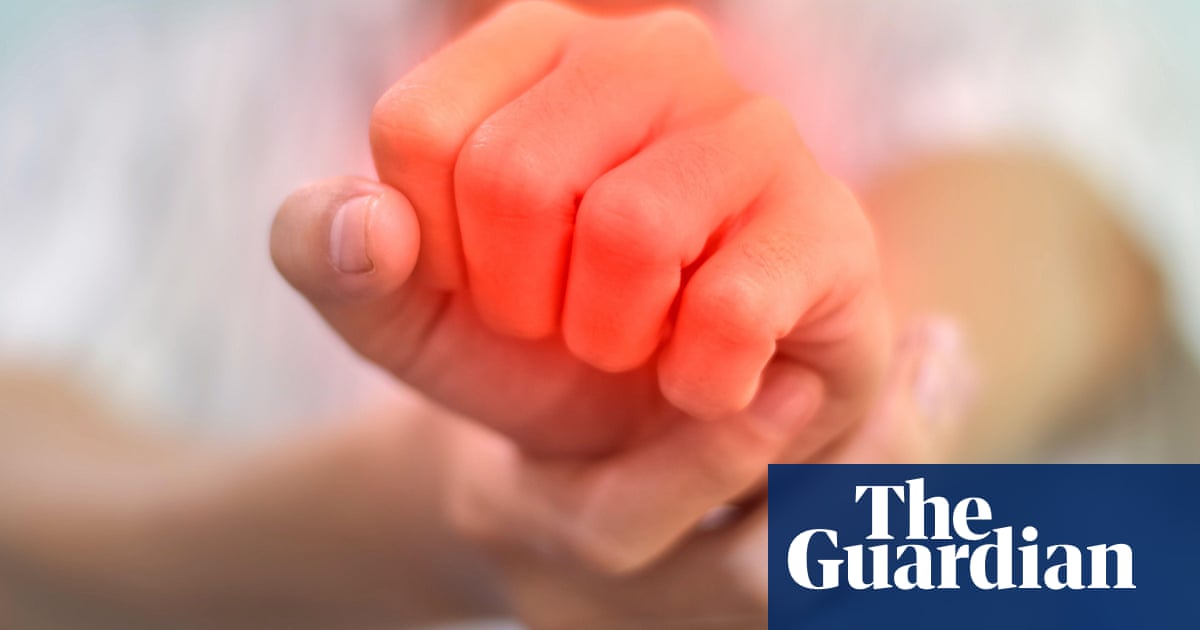 Autoimmune disease may almost double risk of mental ill health, study suggests