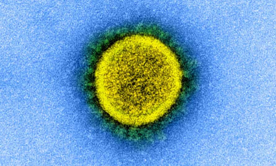 Transmission electron microscope image of Sars-CoV-2 virus.