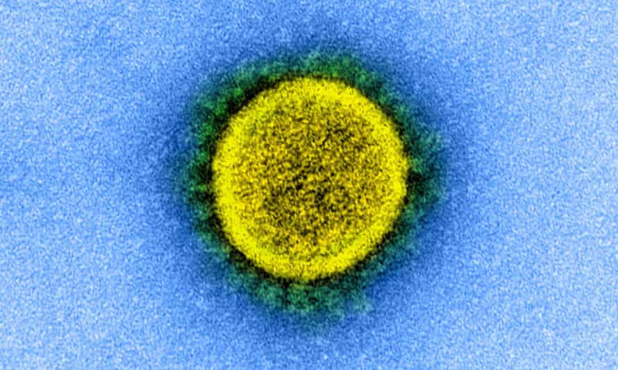 Transmission electron microscope image of the Sars-CoV-2 virus.