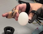 Brain implant helps paralysed man to feed himself and drink from cup