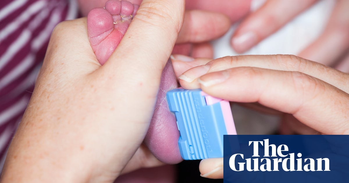 Genome sequencing trial to test benefits of identifying genetic diseases at birth – The Guardian