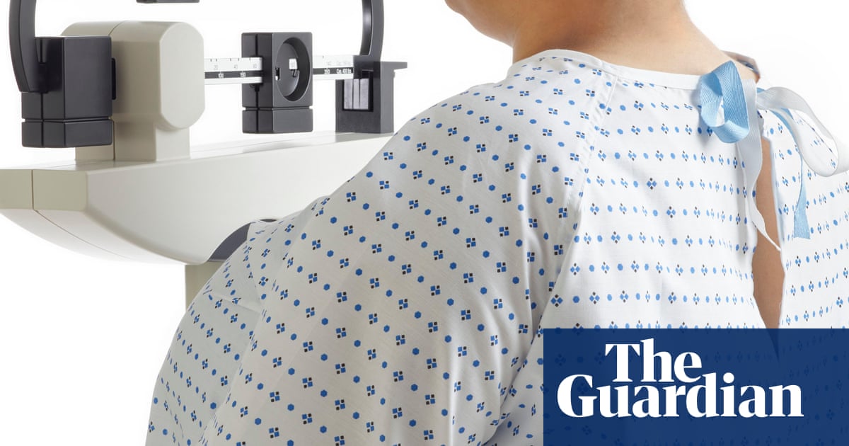 UK’s obesity and overweight epidemic costs £126bn a year, study suggests | Obesity UK’s obesity and overweight epidemic costs £126bn a year, study suggests | Obesity