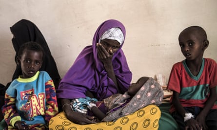 A mother looks at her two-year-old son who’s been diagnosed with severe malnutrition in Somalia, currently on the brink of famine.