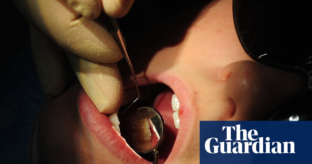 Toxin levels in fish lead to calls for UK-wide ban on mercury dental fillings