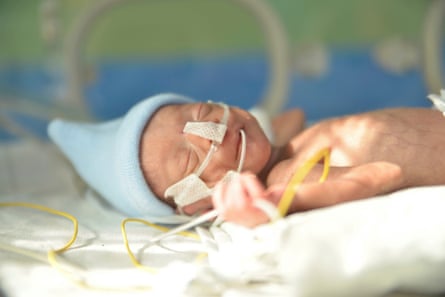 A premature baby lies with its eyes closed, wearing a blue hat. It has an oxygen line taped to its face and a feeding tube inserted into its mouth. 