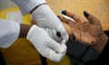 A nurse wearing surgical gloves pricks a person's finger to collect a blood sample