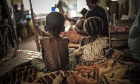 A quarter of the DRC’s population faces hunger and 860,000 under-fives are acutely malnourished.