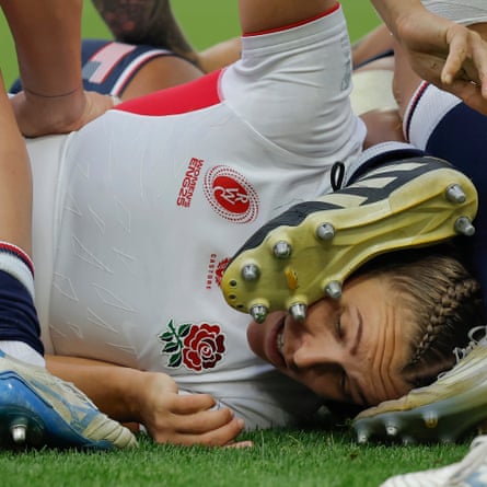 The England captain, Zoe Aldcroft, gets a boot on her head at the bottom of a ruck.