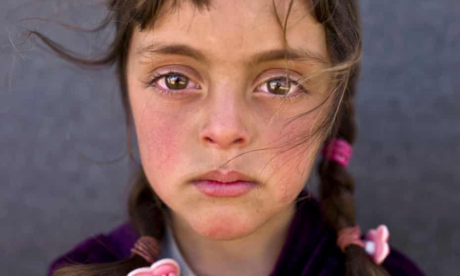 The face of a five-year-old Syrian refugee