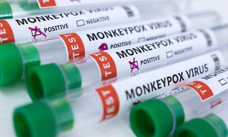 Test tubes labelled ‘Monkeypox virus positive and negative’