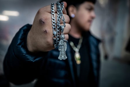 Man with grazed knuckles holds a chain with a religious motif.