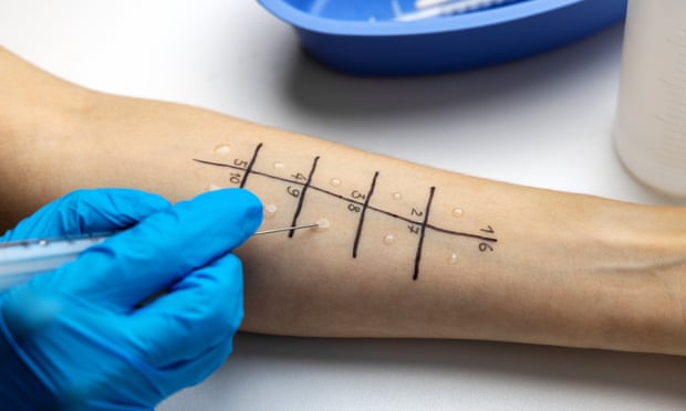 A specialized skin prick test