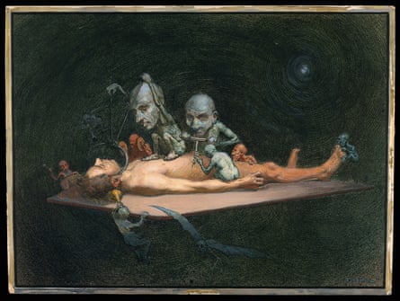 An unconscious naked man lying on a table being attacked by little demons armed with surgical instruments; symbolising the effects of chloroform on the human body. Watercolour by R. Cooper.