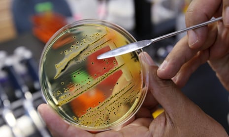 salmonella in a petri dish