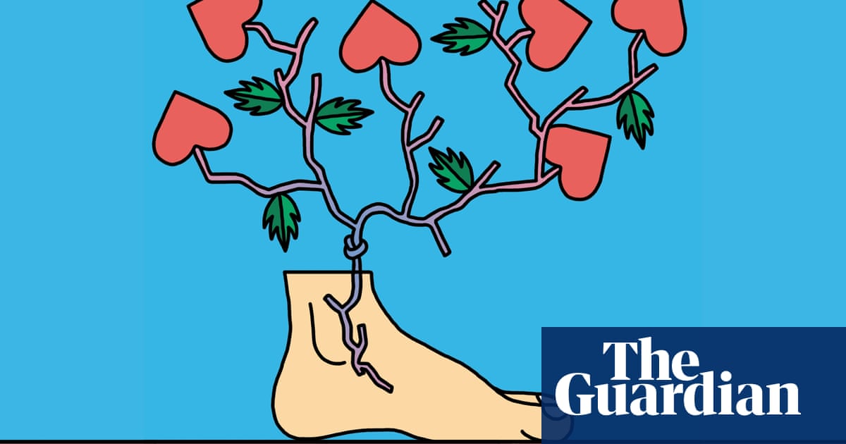 Everything You Wanted To Know About Vein Problems But Were Too Busy Pulling Up Your Socks To Ask Health Wellbeing The Guardian