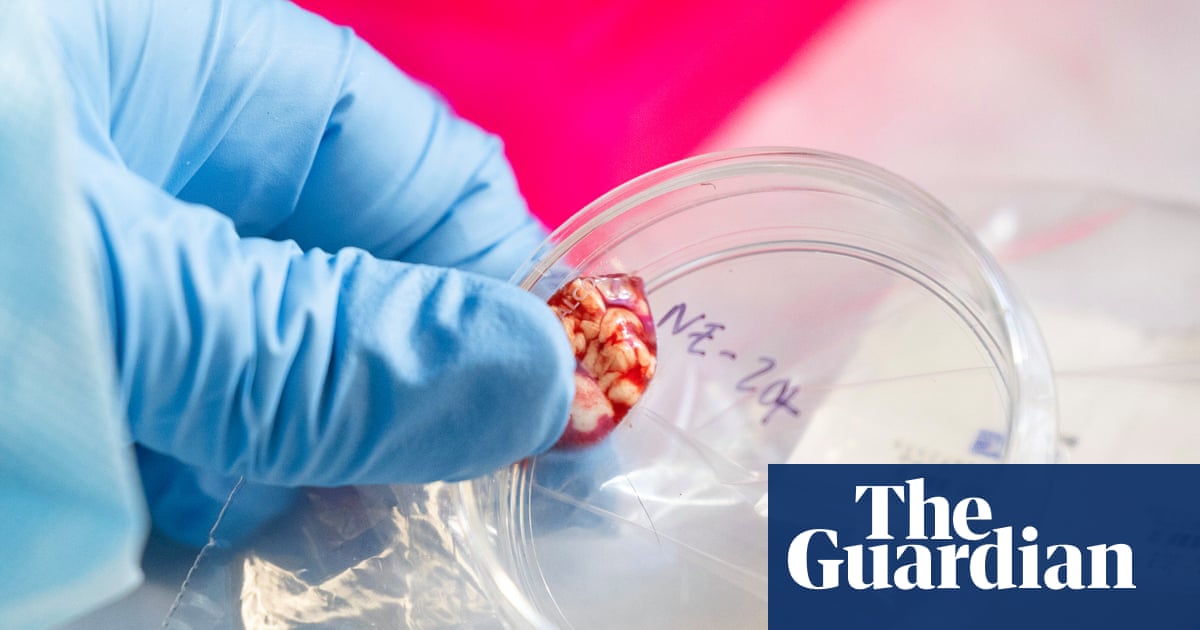 CDC temporarily halts testing for several infectious diseases amid staffing shortages