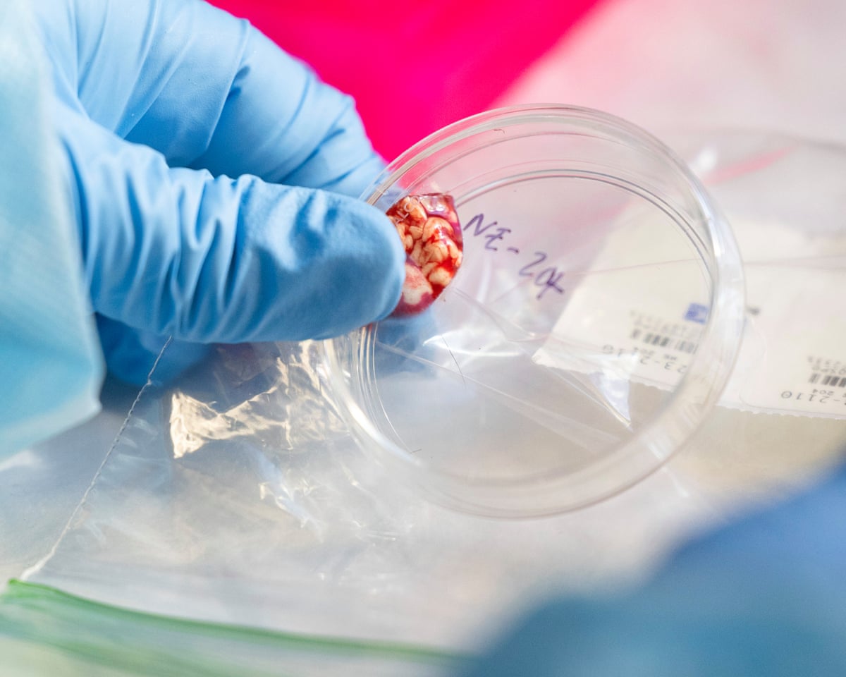 Cdc Temporarily Halts Testing for Several Infectious Diseases Amid Staffing Shortages
