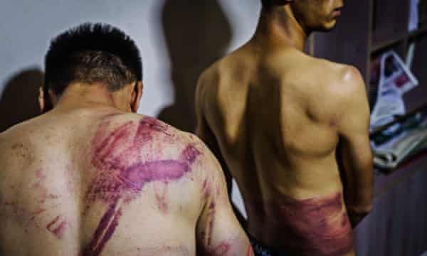 Journalists Nemat Naqdi, 28, (left) and Taqi Daryabi, 22, show the wounds sustained after Taliban fighters tortured and beat them