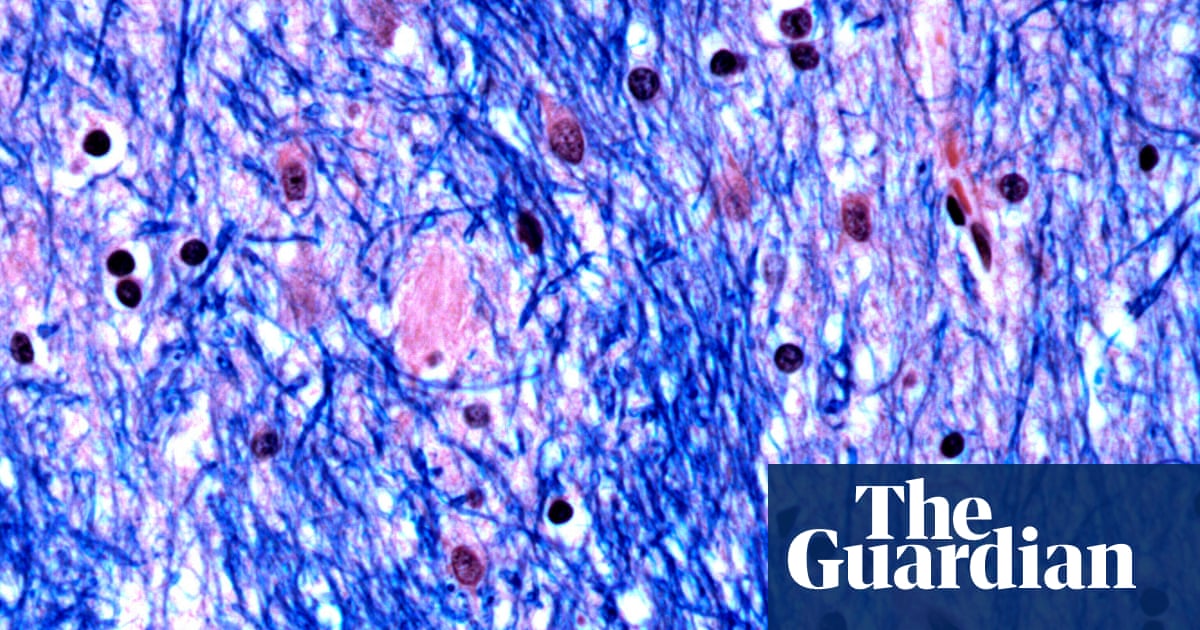 My dad, his ‘incurable’ disease, and hope at last - podcast