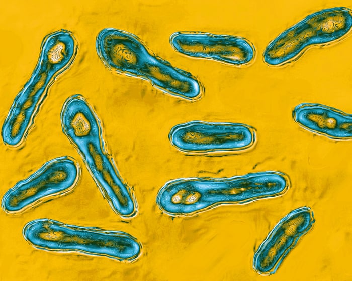 New York City med spa owner admits to giving client botulism with bootleg Botox