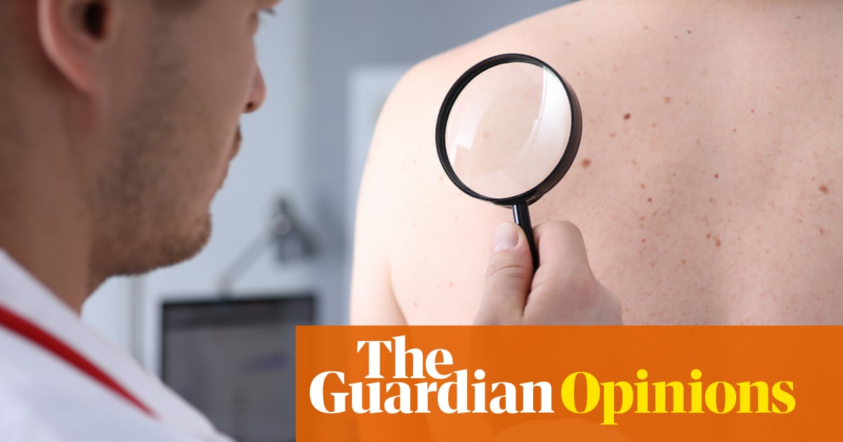 I found something strange on my back – and eventually I just couldn’t ignore it | Adrian Chiles