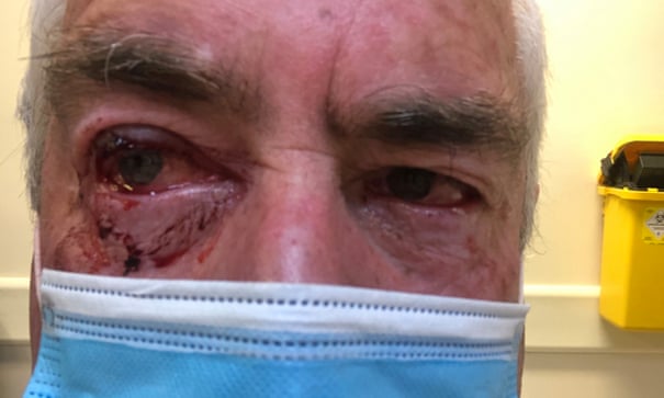 James Glindemann recovers after being swooped by a magpie in the Victorian town of Sale in October.