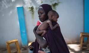 A mother holds her malnourished baby at a health facility in Maiduguri, north-east Nigeria, in September.