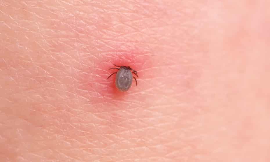 Lyme disease affects 400,000 Americans each year.