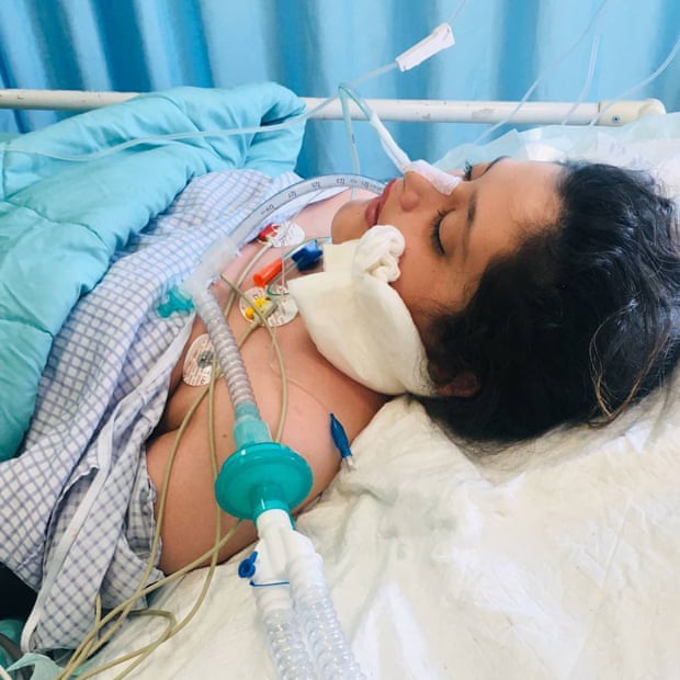 Mahsa Amini in a coma before she died.