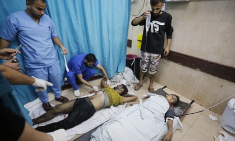 Doctors treat people injured in Israeli attacks at Al-Aqsa Martyrs hospital in Deir Al-Balah.