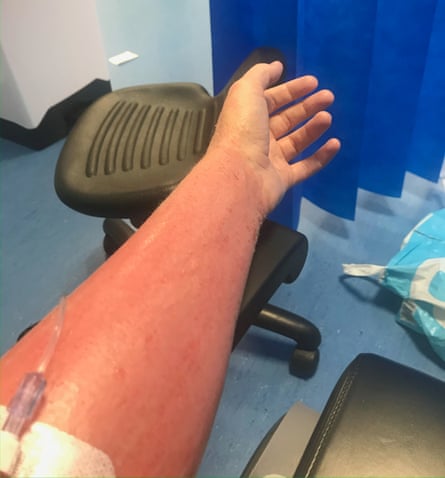 Lowe in hospital, her arm extended, very red and swollen