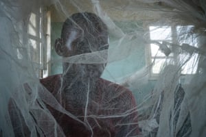 A sleeping sickness patient at Mushie hospital