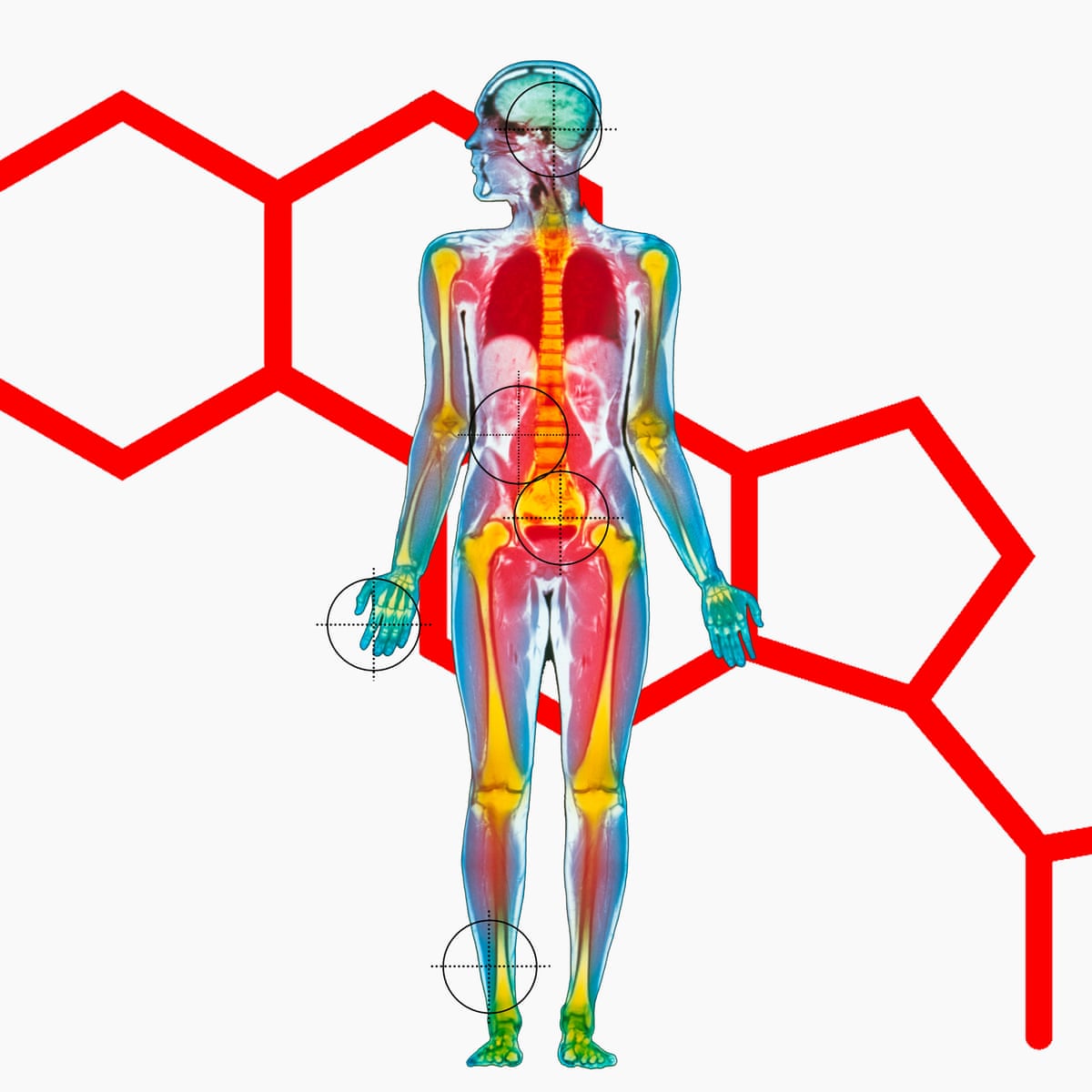 does diabetic ketoacidosis cause bradycardia