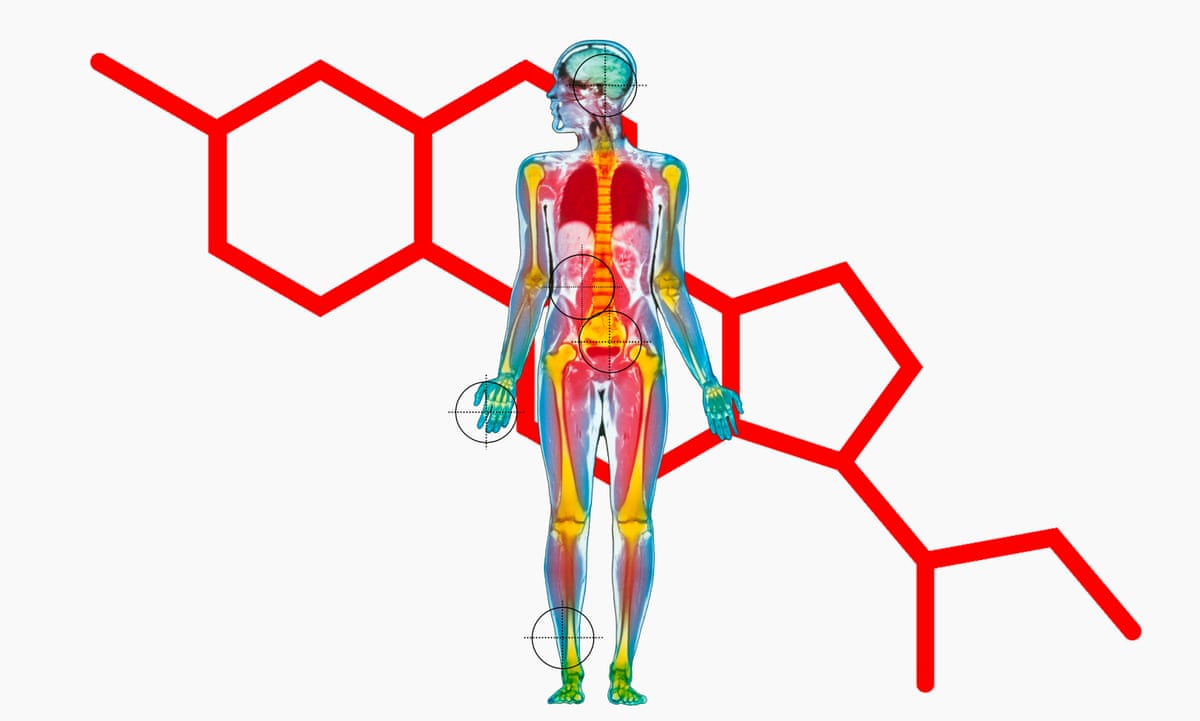 heart racing palms sweaty what does stress do to the body health wellbeing the guardian heart racing palms sweaty what does stress do to the body health wellbeing the guardian