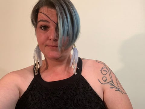 A woman wearing a black tank top wears an eye patch covered by her hair in a selfie