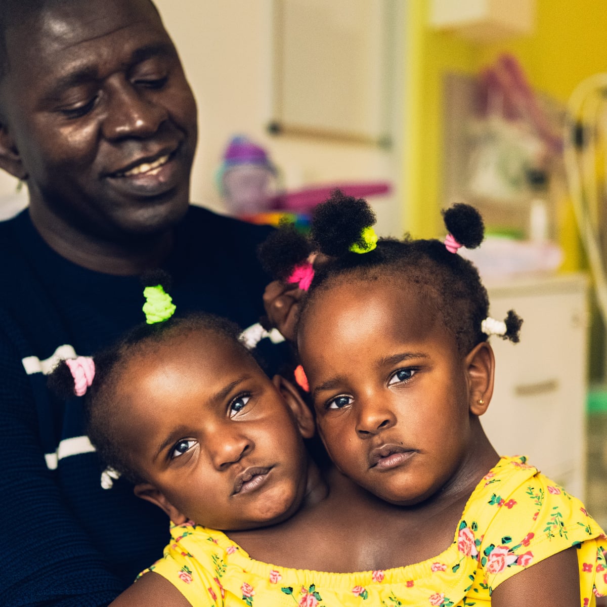 They Are Together They Are Equal The Agonising Choice Facing Father Of Conjoined Twins Health The Guardian They Are Together They Are Equal The Agonising Choice Facing Father Of Conjoined Twins Health The Guardian