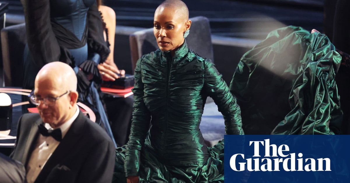 Calls to ‘end the stigma’ around alopecia after Chris Rock Oscars joke