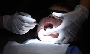 Young child during a dental exam in Sydney, 21 March 2016.