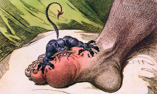 A section from the 1799 cartoon The Gout, by James Gillray.