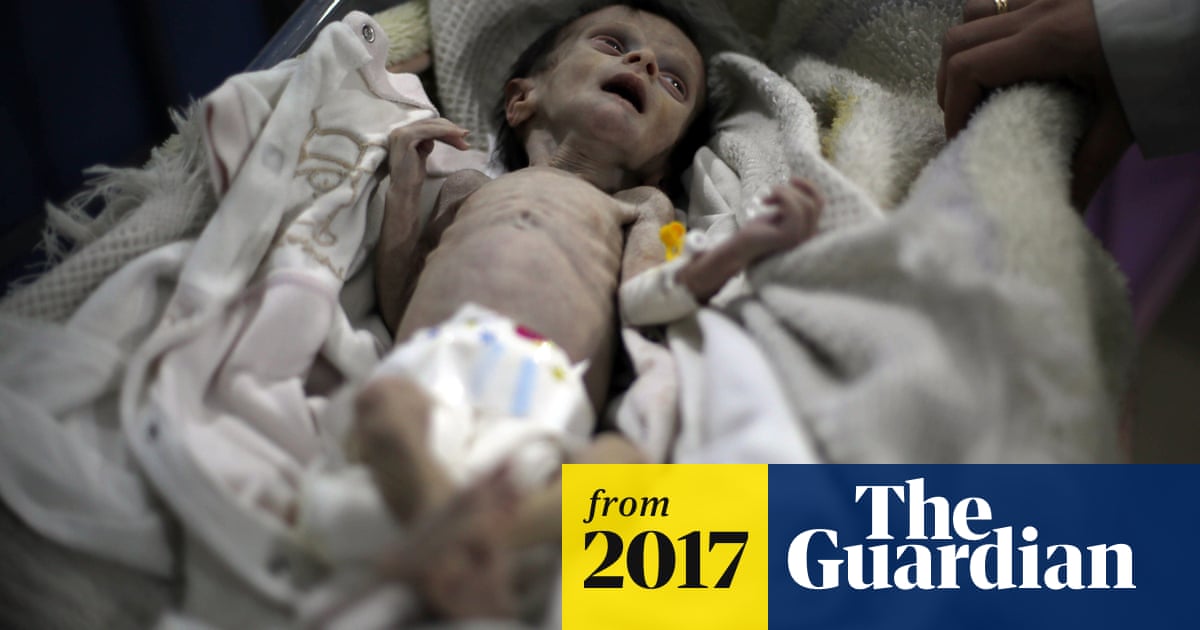 Syria Shocking Images Of Starving Baby Reveal Impact Of Food Crisis Syria The Guardian Syria Shocking Images Of Starving Baby Reveal Impact Of Food Crisis Syria The Guardian