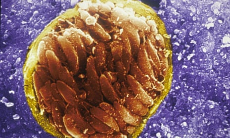 The parasite toxoplasma gondii which has formed a cyst in brain of an infected mouse.