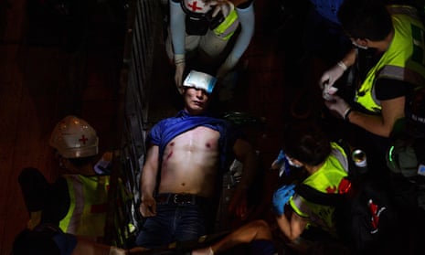 This photo of an injured man during a Hong Kong protest in 2019 by AFP photographer Nicolas Asfouri won first prize in the General News-stories category in the 2020 World Press Photo contest.