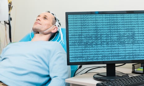 The study recording brain signals sent to trigger organ movement is considered a breakthrough.