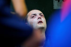 A man looks on after being pepper sprayed.
