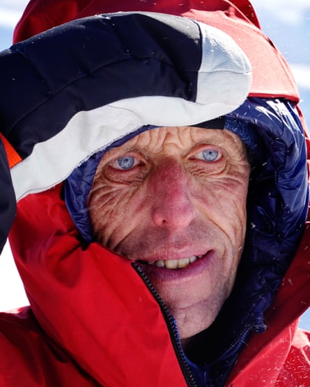 Brian Morrison shades his eyes with his hand